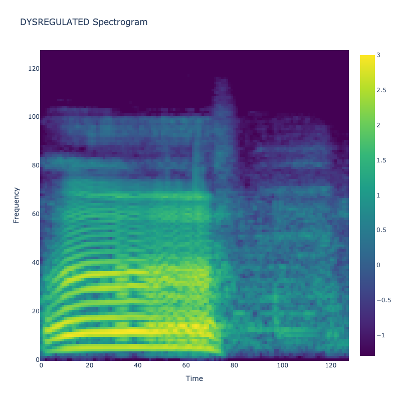 Dysregulated Spectrogram